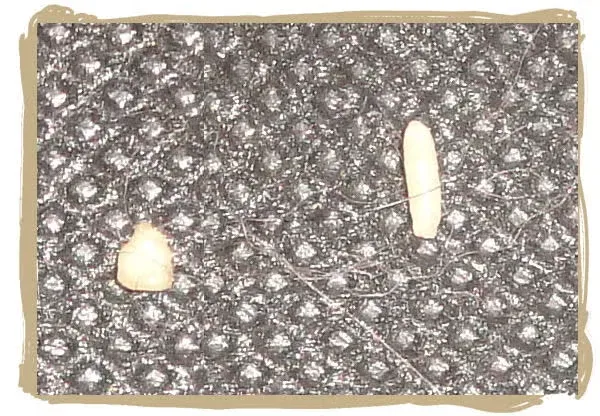 Tapeworm segments close-up