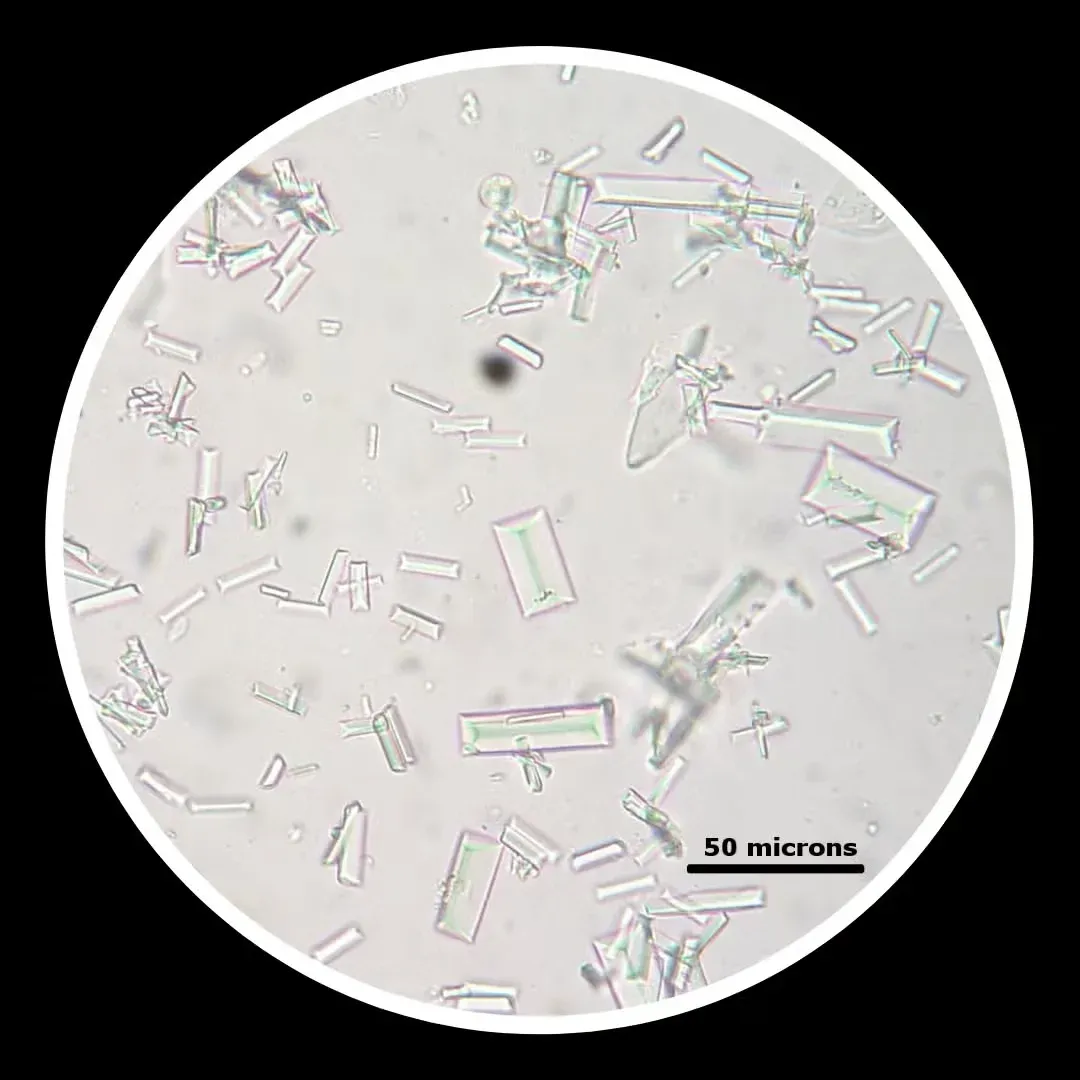 Struvite crystals in dog urine