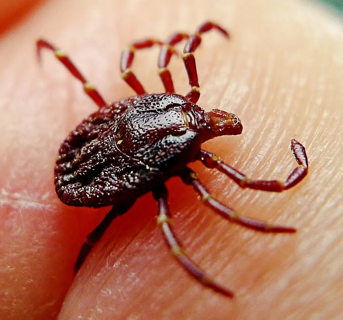 Tick on a human hand
